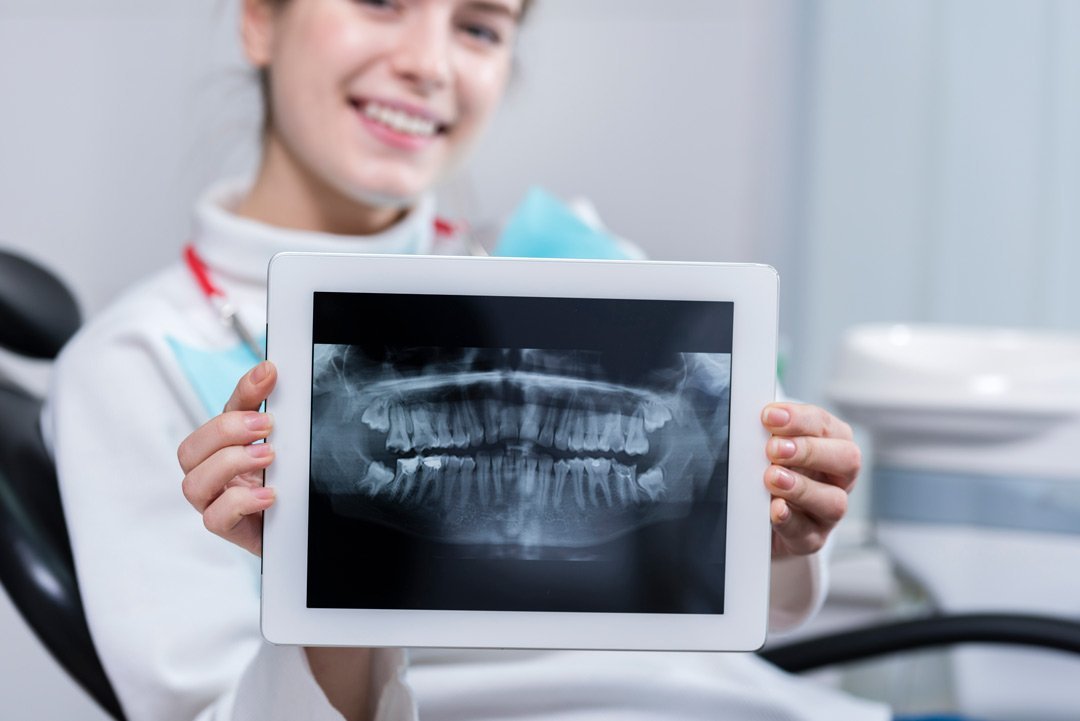 How whitening strips can damage your teeth